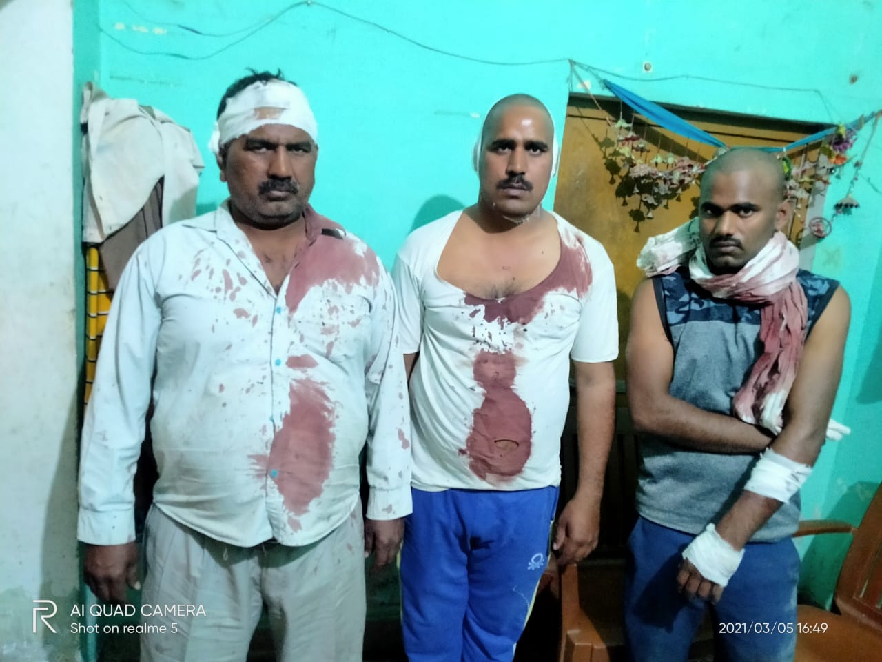 जमीनी विवाद में किसान और उसका परिवार हुआ घायल
