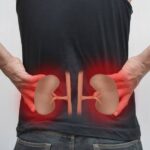 Kidney