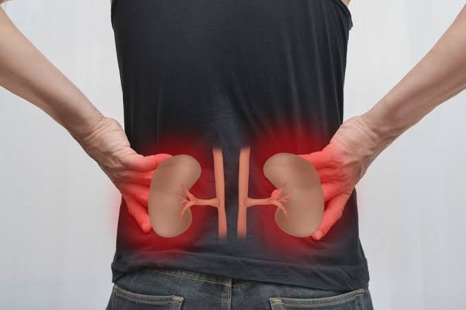 Kidney