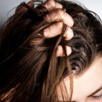 Oily-Hair