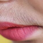Unwanted-Hair-1