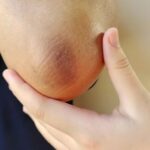 black-elbow