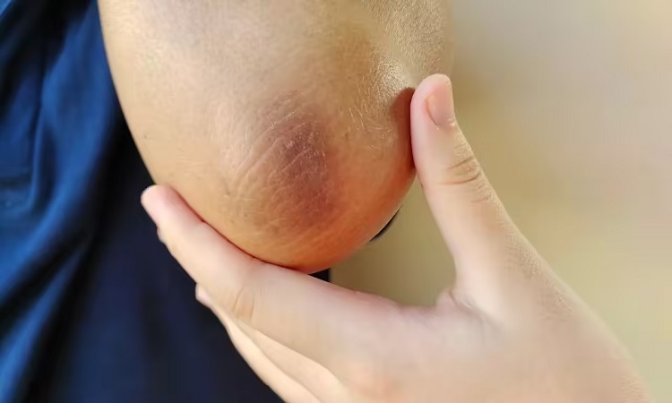 black-elbow