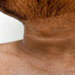 Black-Neck