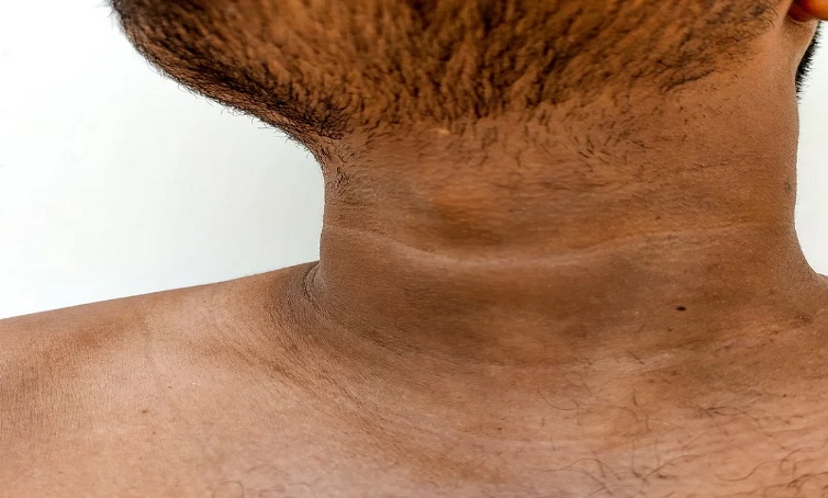 Black-Neck