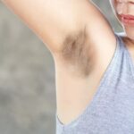 Dark-Underarms