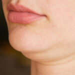 Double-Chin