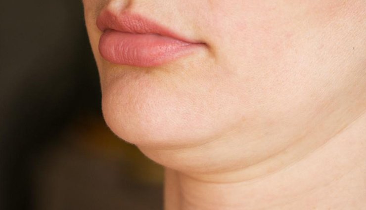 Double-Chin