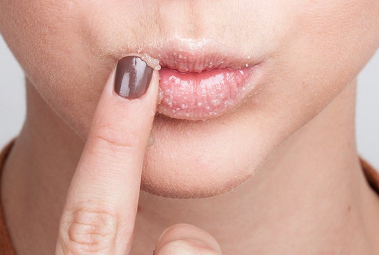 Lips