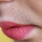 Unwanted-Hair