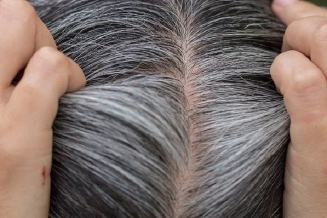 White-Hair-1